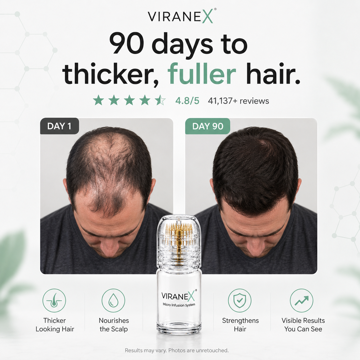 ViraneX™ Peptide Infusion Hair Regrowth System